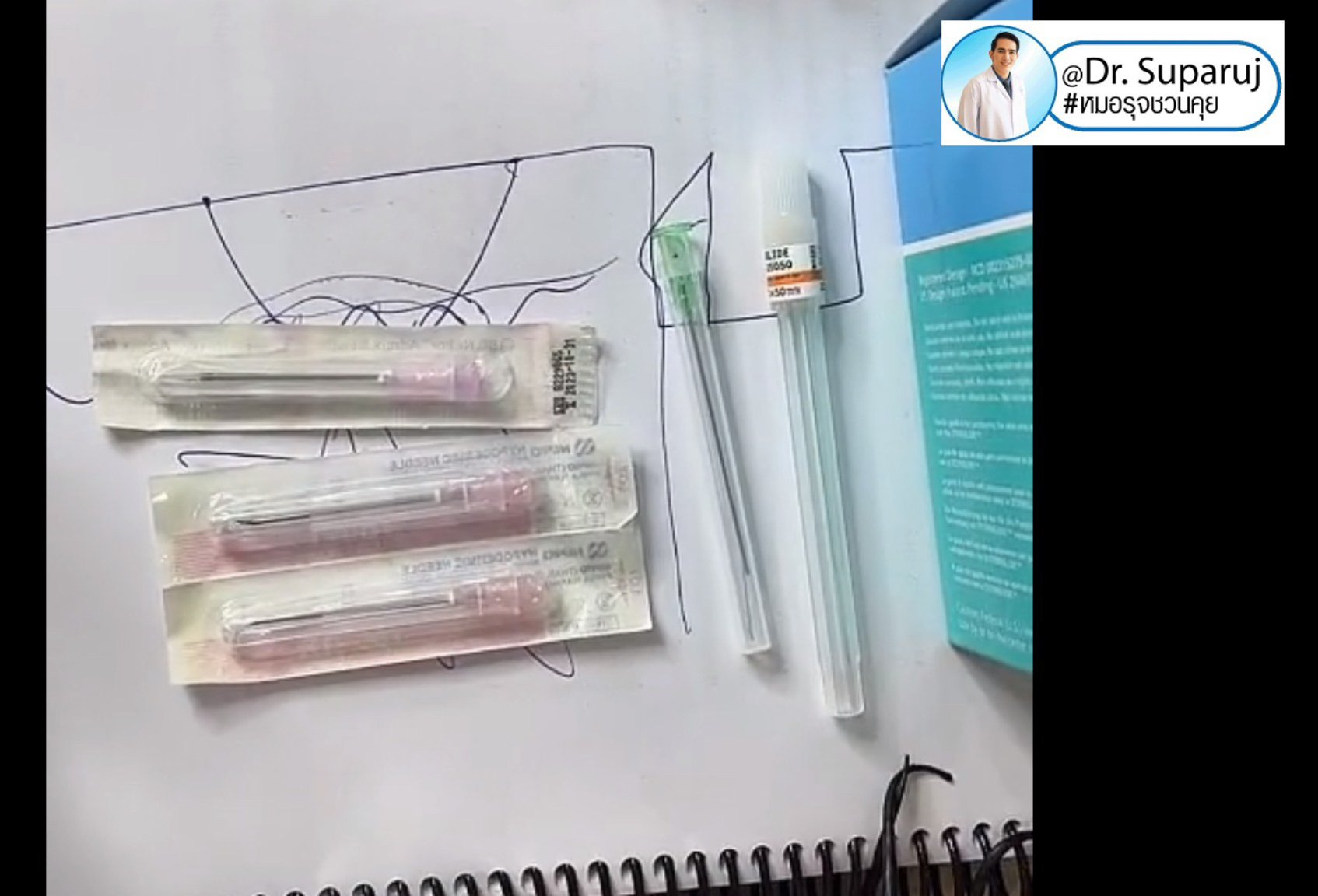 Update เทคนิค Subcision ตัดพังผืดรักษาหลุมสิว Acne Scar Subcision Techniques Update เทคนิค Subcision ตัดพังผืดรักษาหลุมสิว Acne Scar Subcision Techniques