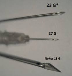 Update เทคนิค Subcision ตัดพังผืดรักษาหลุมสิว Acne Scar Subcision Techniques Update เทคนิค Subcision ตัดพังผืดรักษาหลุมสิว Acne Scar Subcision Techniques