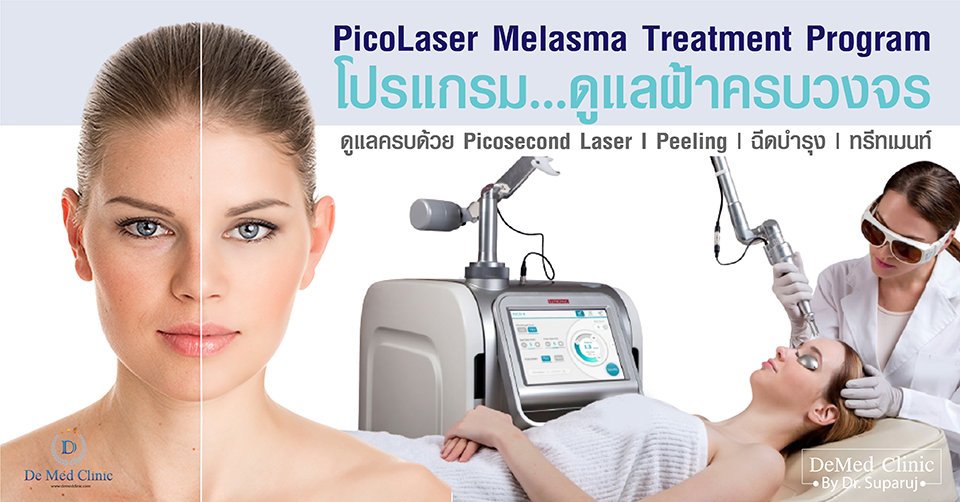 PicoLaser Melasma Treatment Program  โปรแกรมดูแลฝ้าครบวงจร ครบถ้วน 3 เดือน