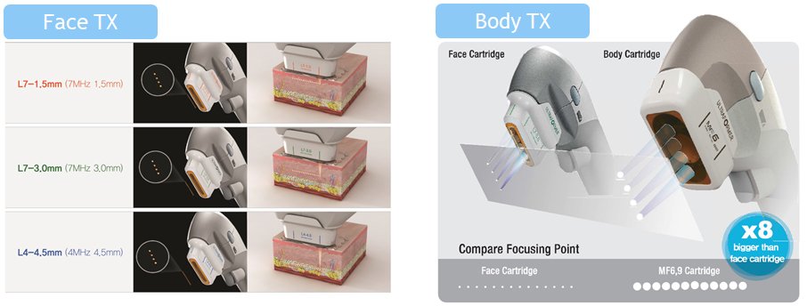 Ultraformer lll หัวยิง MF2 (2.0mm or “MF2” Cartridge) ลดเลือนริ้วรอยรอบดวงตายกกระชับหนังตา ยกคิ้ว