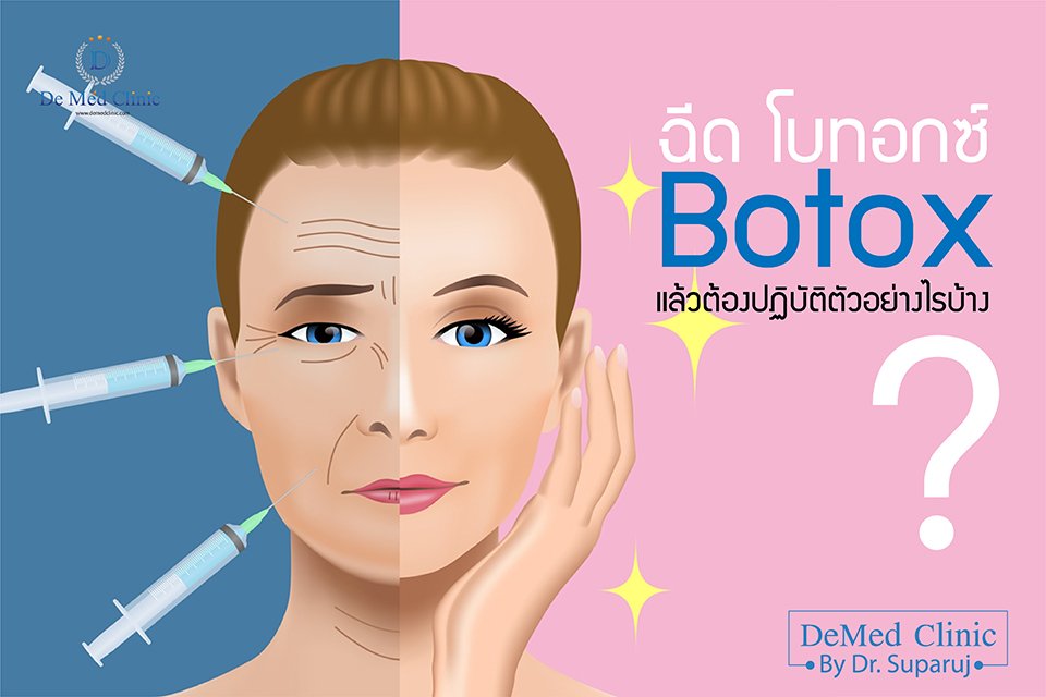 ฉีด โบทอกซ์ Botox แล้วต้องปฏิบัติตัวอย่างไรบ้าง ?