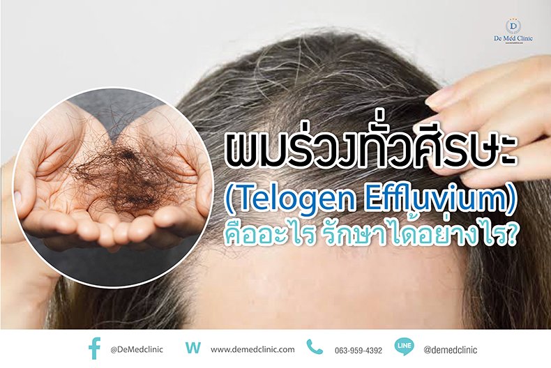 ผมร่วงทั่วศีรษะ (Telogen Effluvium) คืออะไร รักษาได้อย่างไร?