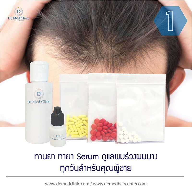 1.ทานยา ทายา Serum ดูแลผมร่วงผมบาง ทุกวันสำหรับคุณผู้ชาย