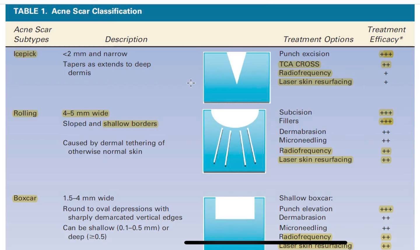 Rolling Acne Scars รอยแผลเป็นหลุมจากสิวที่มีลักษณะกว้าง และตื้น คล้ายกระทะ Rolling Acne Scars รอยแผลเป็นหลุมจากสิวที่มีลักษณะกว้าง และตื้น คล้ายกระทะ