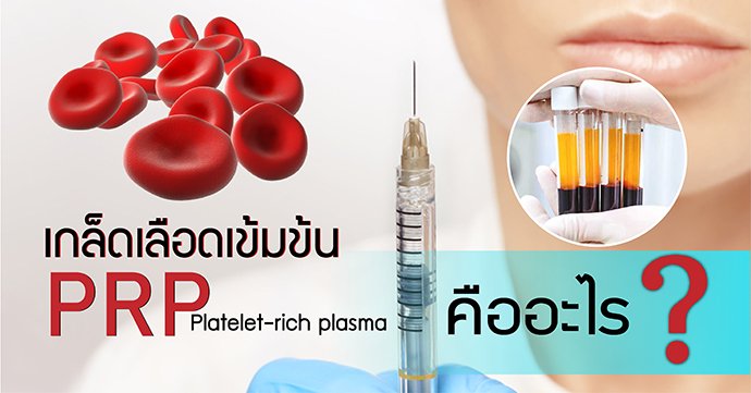 เกล็ดเลือดเข้มข้น PRP Platelet-rich plasma คืออะไร ?