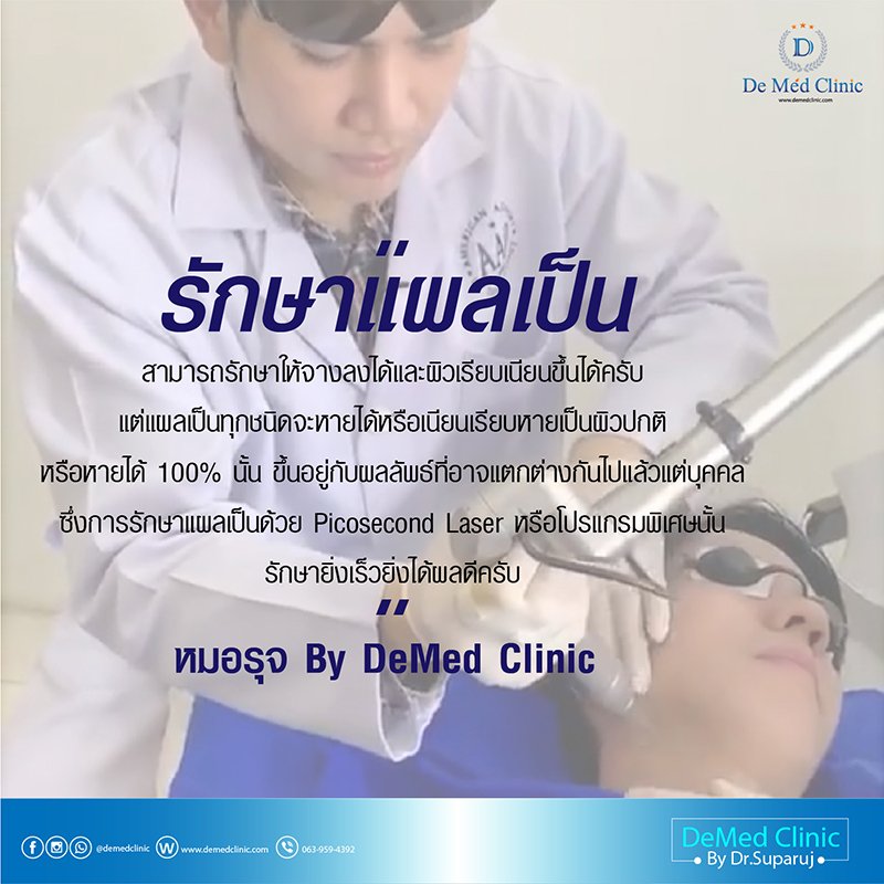 DeMed Clinic By Dr.Suparuj“รอยแผลเป็น”  แผลจากศัลยกรรม (Surgery scars)@demedclinicwww.demedclinic.com063-959-4392 DeMed Clinic By Dr.Suparuj“รอยแผลเป็น”  แผลจากสิวอักเสบ (Acne Scars)@demedclinicwww.demedclinic.com063-959-4392 DeMed Clinic By Dr.Suparuj“รอยแผลเป็น”  แผลจากหลุมสิว (Acne Scars)@demedclinicwww.demedclinic.com063-959-4392 “รอยแผลเป็น”  แผลจากผ่าตัด (Surgical Scar)DeMed Clinic By Dr.Suparuj@demedclinicwww.demedclinic.com063-959-4392 หมดปัญหาผิวไม่เรียบ ไม่สวยจากรอยแผลเป็น หลุมสิว หรือรอยแผลทุกชนิด ที่ทำให้ผิวเป็นรอยรักษาให้ดีขึ้นได้ด้วยเทคโนโลยีใหม่ล่าสุดด้านเทคนิคพิเศษเฉพาะที่ DeMed ClinicPicosecond Laserรักษารอยแผลเป็นด้วยนวัตกรรมDeMed Clinic By Dr.Suparuj@demedclinicwww.demedclinic.com063-959-4392 “ รักษาแผลเป็น สามารถรักษาให้จางลงได้และผิวเรียบเนียนขึ้นได้ครับ แต่แผลเป็นทุกชนิดจะหายได้หรือเนียนเรียบหายเป็นผิวปกติ หรือหายได้ 100% นั้น ขึ้นอยู่กับผลลัพธ์ที่อาจแตกต่างกันไปแล้วแต่บุคคล ซึ่งการรักษาแผลเป็นด้วย Picosecond Laser หรือโปรแกรมพิเศษนั้น รักษายิ่งเร็วยิ่งได้ผลดีครับ ” หมอรุจ By DeMed Clinic 