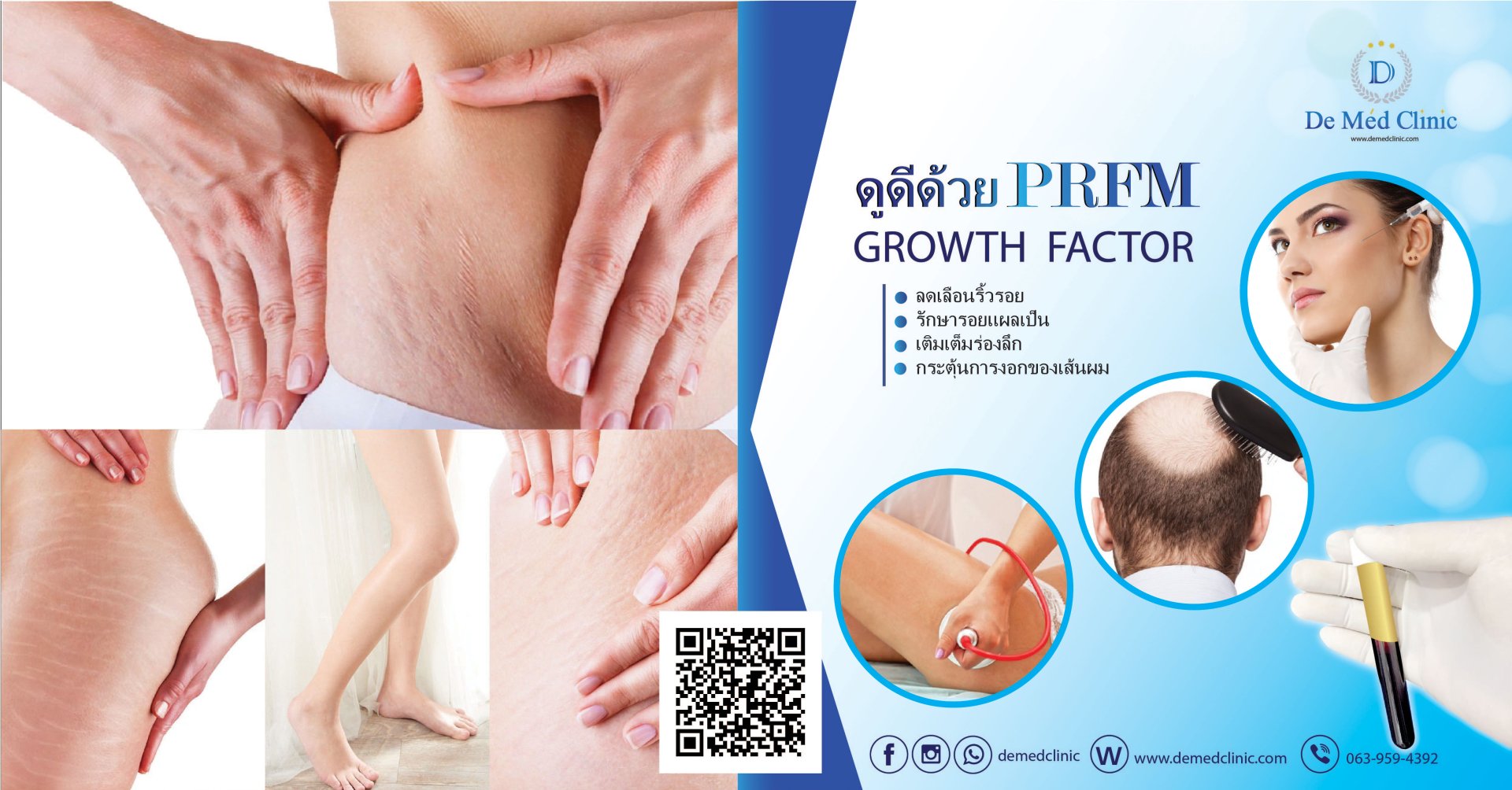 Premium PRFM Platelet-Rich Fibrin Matrix Cell Therapy