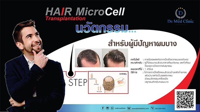 ปลูกผมด้วย Hair MicroCell Transplantation (HMT) การปลูกผมโดยใช้เซลล์รากผมตนเองโดยไม่ต้องผ่าตัด 