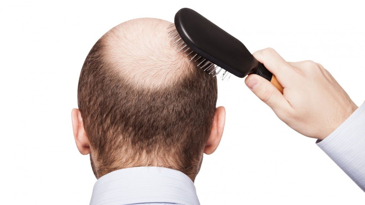ดูแลรักษา #ผมร่วง ผมบาง ด้วย Premium Hair