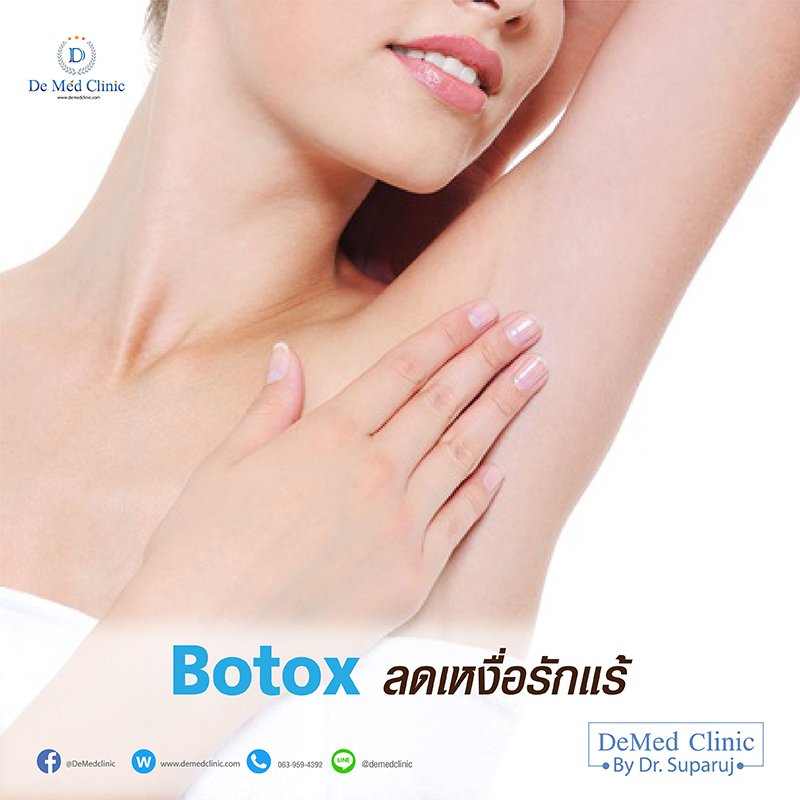 Botox ลดเหงื่อรักแร้ Botox ลดเหงื่อรักแร้