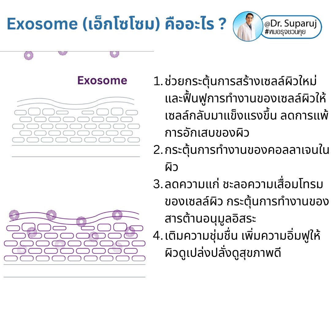 Exosome (เอ็กโซโซม) คือ เทคโนโลยีที่มีองค์ประกอบของโปรตีนขนาดเล็กมาก เป็นลักษณะวงกลมขนาดเพียง 30-100 nm ซึ่งมีขนาดเล็กกว่าเซลล์ทั่วไปถึง 1/1,000 เท่า โดยใน Exosome มีสารชีวโมเลกุล 1,000 ชนิด  Exosome (เอ็กโซโซม) คือ เทคโนโลยีที่มีองค์ประกอบของโปรตีนขนาดเล็กมาก เป็นลักษณะวงกลมขนาดเพียง 30-100 nm ซึ่งมีขนาดเล็กกว่าเซลล์ทั่วไปถึง 1/1,000 เท่า โดยใน Exosome มีสารชีวโมเลกุล 1,000 ชนิด