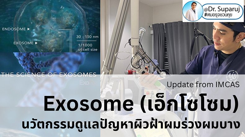 Exosome (เอ็กโซโซม) นวัตกรรมดูแลปัญหาผิว ฝ้า ผมร่วงผมบาง คืออะไรช่วยอะไรได้บ้าง ? (Update from IMCAS)