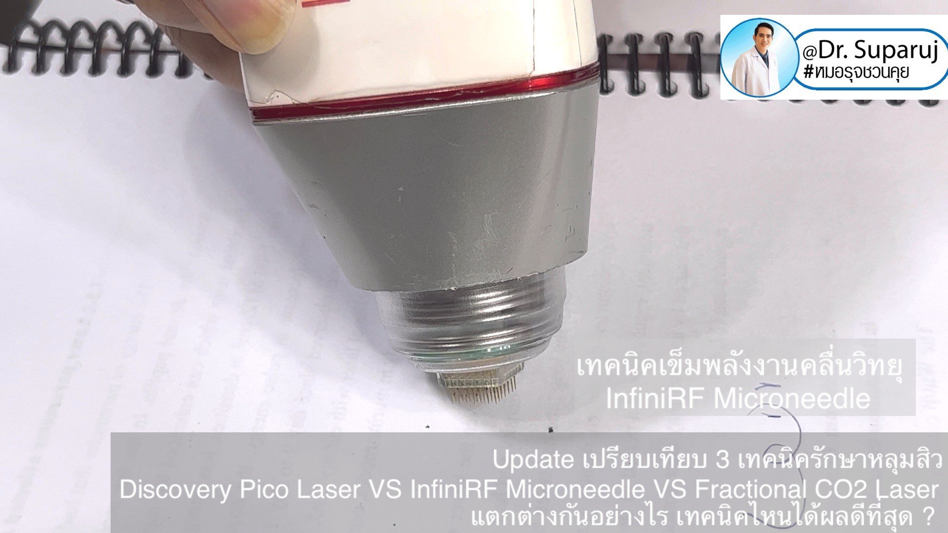ผลการรักษาหลุมสิวด้วย Picosecond Laser VS InfiniRF Microneedle แตกต่างกันอย่างไร อะไรมีประสิทธิภาพดีกว่า ? ผลการรักษาหลุมสิวด้วย Picosecond Laser VS InfiniRF Microneedle แตกต่างกันอย่างไร อะไรมีประสิทธิภาพดีกว่า ?