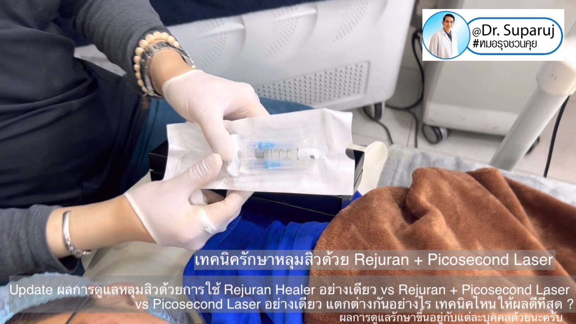 Update ผลการรักษาหลุมสิวด้วยเทคนิค Rejuran Healer อย่างเดียว vs Rejuran + Picosecond Laser vs Picosecond Laser อย่างเดียว แตกต่างกันอย่างไร เทคนิคไหนให้ผลดีที่สุด ? Update ผลการรักษาหลุมสิวด้วยเทคนิค Rejuran Healer อย่างเดียว vs Rejuran + Picosecond Laser vs Picosecond Laser อย่างเดียว แตกต่างกันอย่างไร เทคนิคไหนให้ผลดีที่สุด ?