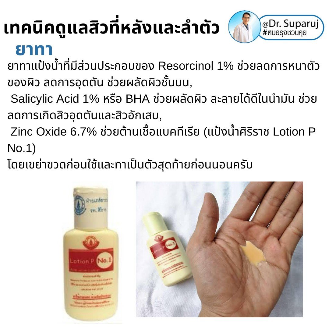 สิวที่หลัง และลำตัว Truncal & Body Acne เกิดจากอะไรและดูแลรักษาได้อย่างไร ? (Update + รีวิว) สิวที่หลัง และลำตัว Truncal & Body Acne เกิดจากอะไรและดูแลรักษาได้อย่างไร ? (Update + รีวิว)