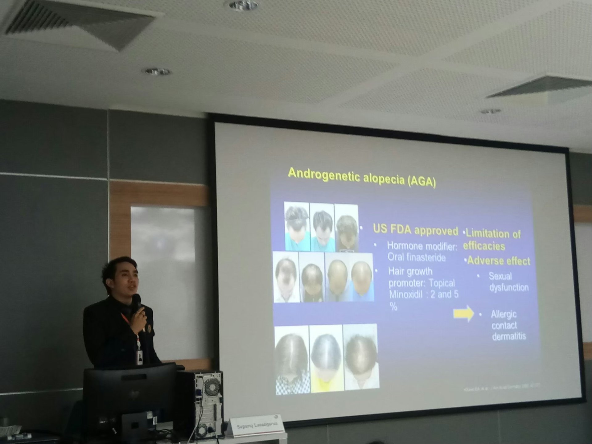 แนะนำเทคนิคดูแลรักษาผมร่วงผมบาง: ยารักษาผมร่วงผมบางมีอะไรบ้างและเลือกใช้อย่างไร? แนะนำเทคนิคดูแลรักษาผมร่วงผมบาง: ยารักษาผมร่วงผมบางมีอะไรบ้างและเลือกใช้อย่างไร?