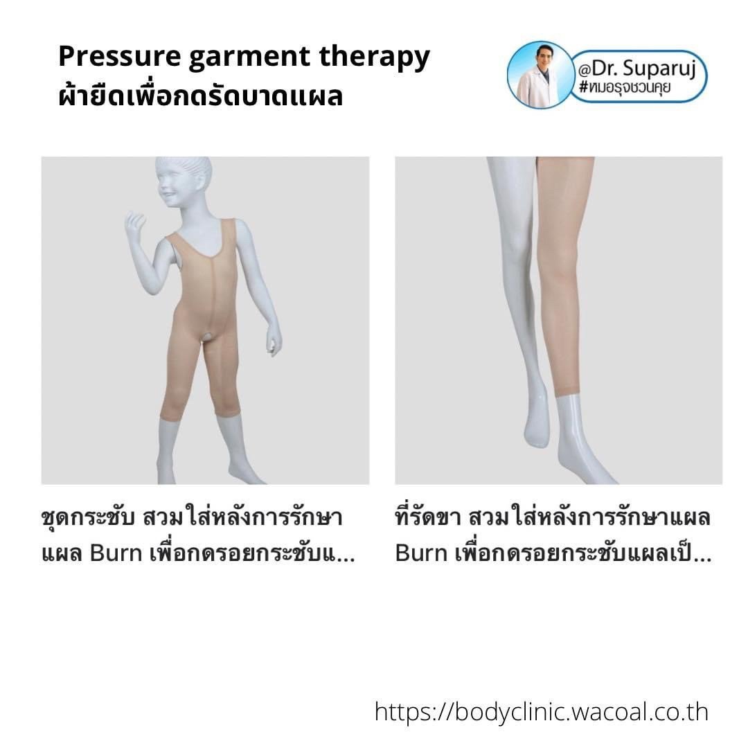 แนะนำเทคนิคดูแลแผลเป็นนูนคีลอยด์: ป้องกันการเป็นซ้ำของแผลเป็นนูนคีลอยด์ด้วยการใช้ Pressure garment therapy ผ้ายืดเพื่อกดรัดบาดแผล แนะนำเทคนิคดูแลแผลเป็นนูนคีลอยด์: ป้องกันการเป็นซ้ำของแผลเป็นนูนคีลอยด์ด้วยการใช้ Pressure garment therapy ผ้ายืดเพื่อกดรัดบาดแผล