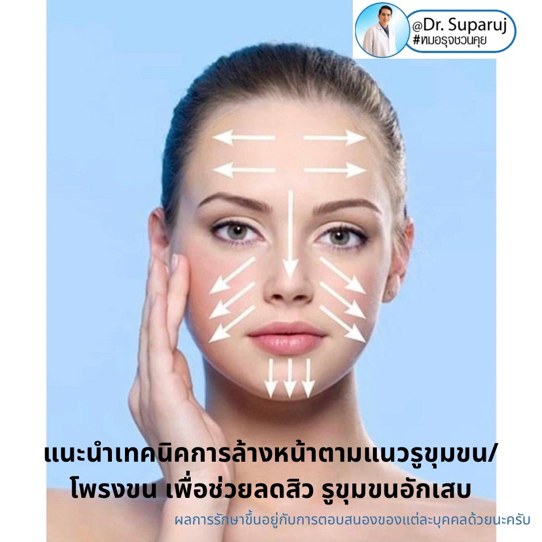 แนะนำเทคนิคการล้างหน้าตามแนวรูขุมขน/ โพรงขน เพื่อช่วยลดสิว รูขุมขนอักเสบ แนะนำเทคนิคการล้างหน้าตามแนวรูขุมขน/ โพรงขน เพื่อช่วยลดสิว รูขุมขนอักเสบ