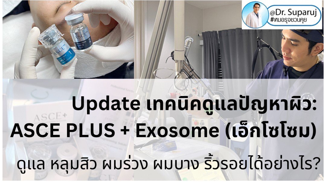 Exosome (เอ็กโซโซม) คือ เทคโนโลยีที่มีองค์ประกอบของโปรตีนขนาดเล็กมาก เป็นลักษณะวงกลมขนาดเพียง 30-100 nm ซึ่งมีขนาดเล็กกว่าเซลล์ทั่วไปถึง 1/1,000 เท่า โดยใน Exosome มีสารชีวโมเลกุล 1,000 ชนิด 