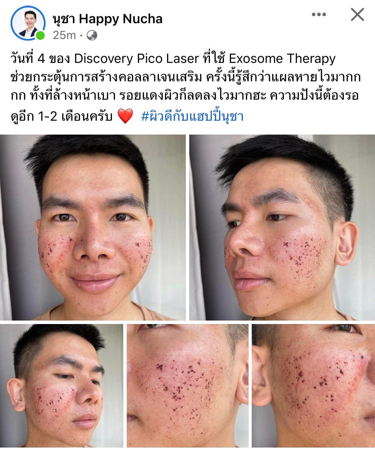 Testimonials รีวิวผลการรักษา ความประทับใจจากคนไข้ ที่มาใช้บริการที่  DeMed Clinic