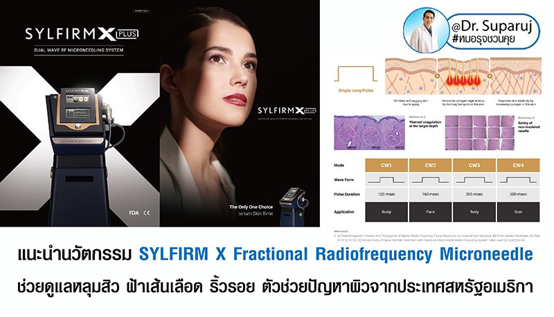 แนะนำนวัตกรรม SYLFIRM X Fractional Radiofrequency Microneedle ช่วยดูแลหลุมสิว ฝ้าเส้นเลือด ริ้วรอย ตัวช่วยปัญหาผิวจากประเทศสหรัฐอเมริกา