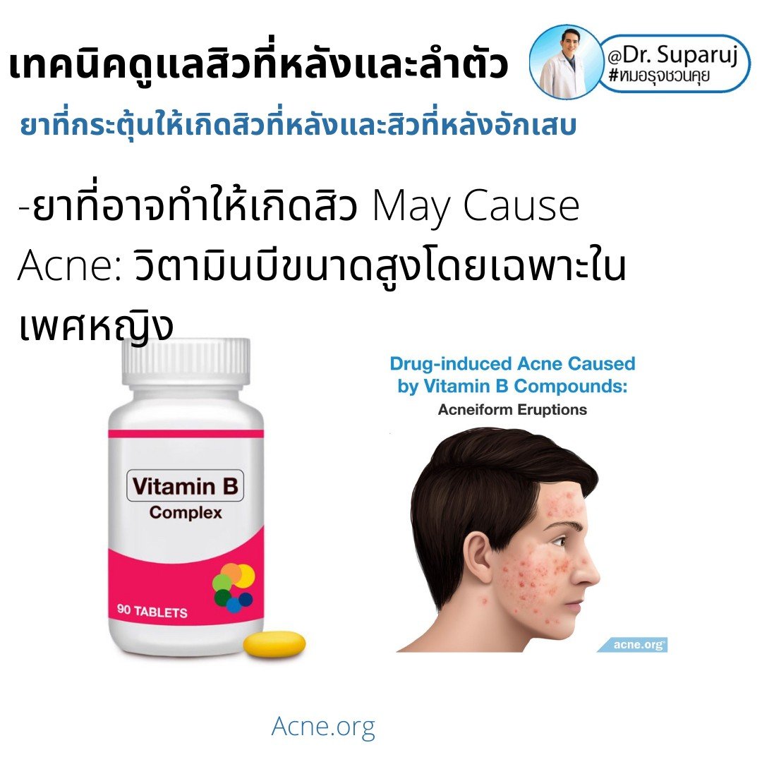 สิวที่หลัง และลำตัว Truncal & Body Acne เกิดจากอะไรและดูแลรักษาได้อย่างไร ? (Update + รีวิว)