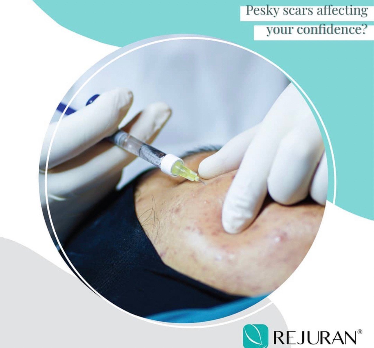 Rejuran Healer Polynucleotide Skin Booster ช่วยฟื้นฟูสร้างเซลล์ผิวใหม่ ดูแลหลุมสิว รูขุมขนกว้าง ริ้วรอย Rejuran Healer Polynucleotide Skin Booster ช่วยฟื้นฟูสร้างเซลล์ผิวใหม่ ดูแลหลุมสิว รูขุมขนกว้าง ริ้วรอย