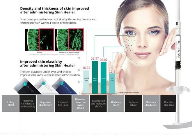 Rejuran Healer Polynucleotide Skin Booster ช่วยฟื้นฟูสร้างเซลล์ผิวใหม่ ดูแลหลุมสิว รูขุมขนกว้าง ริ้วรอย Rejuran Healer Polynucleotide Skin Booster ช่วยฟื้นฟูสร้างเซลล์ผิวใหม่ ดูแลหลุมสิว รูขุมขนกว้าง ริ้วรอย