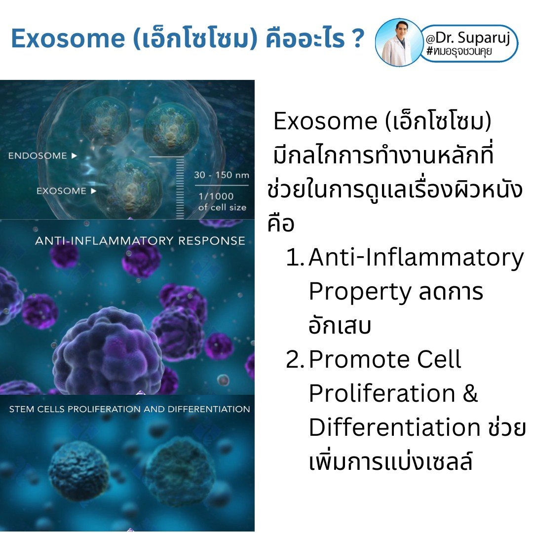 Exosome (เอ็กโซโซม) คือ เทคโนโลยีที่มีองค์ประกอบของโปรตีนขนาดเล็กมาก เป็นลักษณะวงกลมขนาดเพียง 30-100 nm ซึ่งมีขนาดเล็กกว่าเซลล์ทั่วไปถึง 1/1,000 เท่า โดยใน Exosome มีสารชีวโมเลกุล 1,000 ชนิด  Exosome (เอ็กโซโซม) คือ เทคโนโลยีที่มีองค์ประกอบของโปรตีนขนาดเล็กมาก เป็นลักษณะวงกลมขนาดเพียง 30-100 nm ซึ่งมีขนาดเล็กกว่าเซลล์ทั่วไปถึง 1/1,000 เท่า โดยใน Exosome มีสารชีวโมเลกุล 1,000 ชนิด