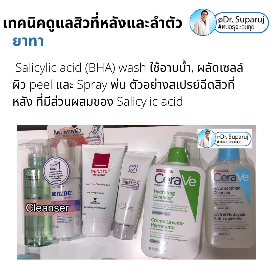 สิวที่หลัง และลำตัว Truncal & Body Acne เกิดจากอะไรและดูแลรักษาได้อย่างไร ? (Update + รีวิว) สิวที่หลัง และลำตัว Truncal & Body Acne เกิดจากอะไรและดูแลรักษาได้อย่างไร ? (Update + รีวิว)