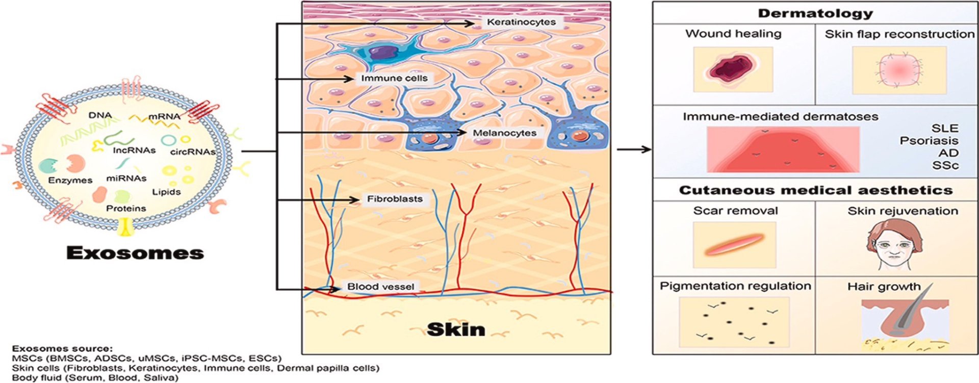 Exosome (เอ็กโซโซม) คือ เทคโนโลยีที่มีองค์ประกอบของโปรตีนขนาดเล็กมาก เป็นลักษณะวงกลมขนาดเพียง 30-100 nm ซึ่งมีขนาดเล็กกว่าเซลล์ทั่วไปถึง 1/1,000 เท่า โดยใน Exosome มีสารชีวโมเลกุล 1,000 ชนิด  Exosome (เอ็กโซโซม) คือ เทคโนโลยีที่มีองค์ประกอบของโปรตีนขนาดเล็กมาก เป็นลักษณะวงกลมขนาดเพียง 30-100 nm ซึ่งมีขนาดเล็กกว่าเซลล์ทั่วไปถึง 1/1,000 เท่า โดยใน Exosome มีสารชีวโมเลกุล 1,000 ชนิด
