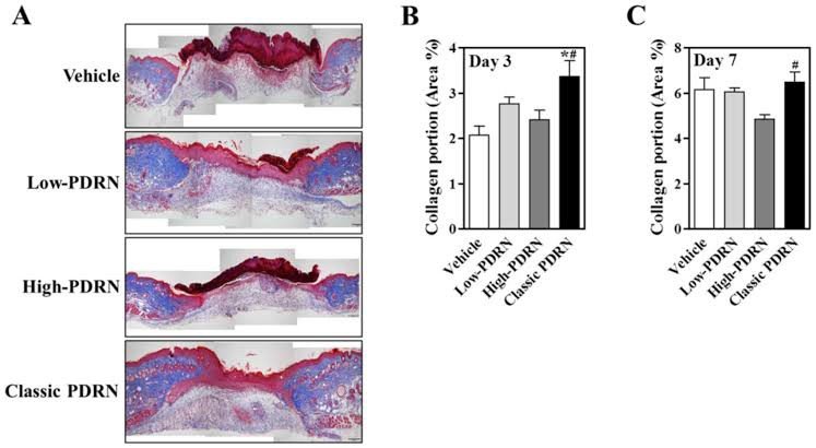 Rejuran Healer Polynucleotide Skin Booster ช่วยฟื้นฟูสร้างเซลล์ผิวใหม่ ดูแลหลุมสิว รูขุมขนกว้าง ริ้วรอย Rejuran Healer Polynucleotide Skin Booster ช่วยฟื้นฟูสร้างเซลล์ผิวใหม่ ดูแลหลุมสิว รูขุมขนกว้าง ริ้วรอย