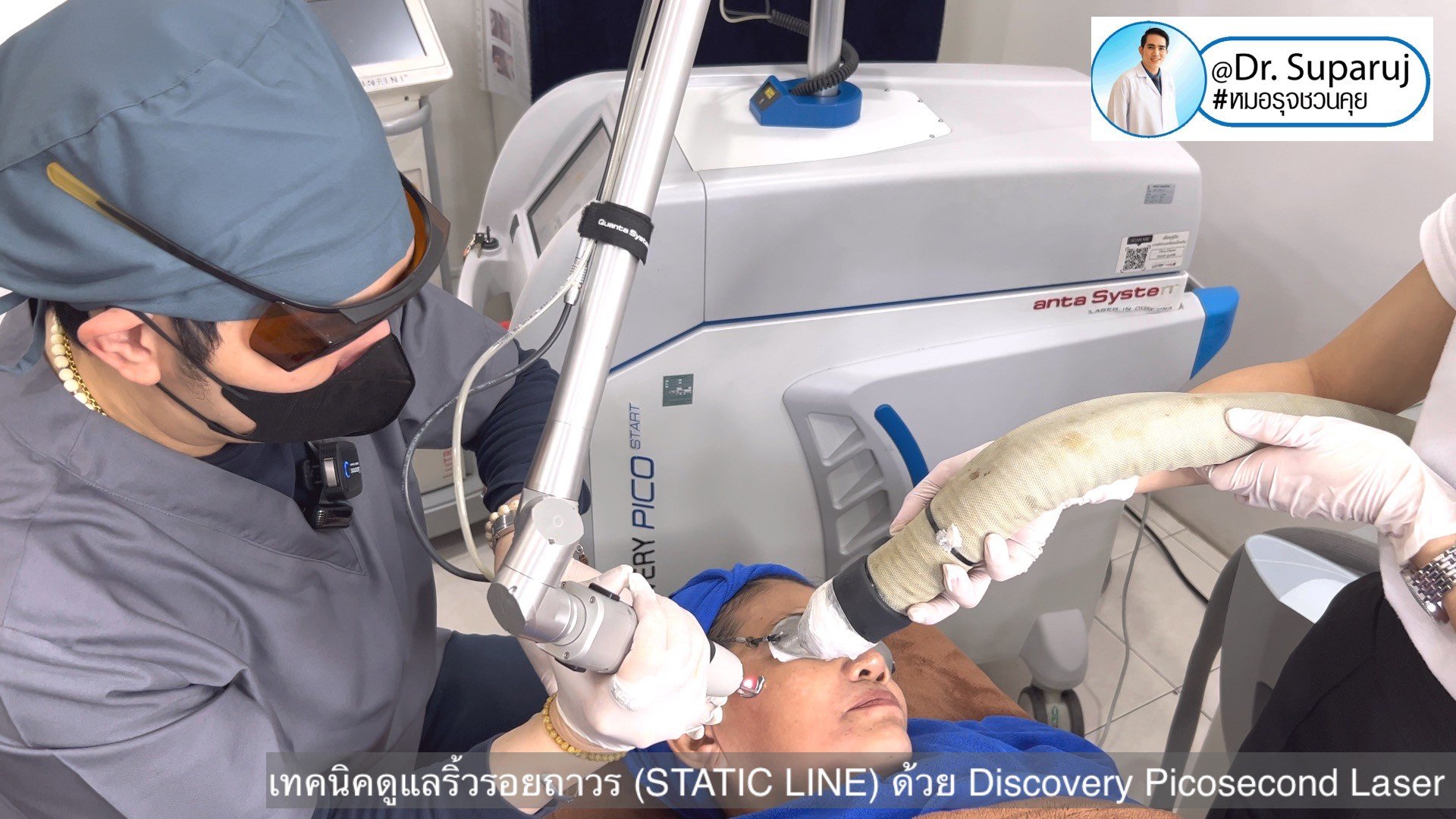 เทคนิคดูแลริ้วรอยถาวร (STATIC LINE) ด้วย Discovery Picosecond Laser เทคนิคดูแลริ้วรอยถาวร (STATIC LINE) ด้วย Discovery Picosecond Laser
