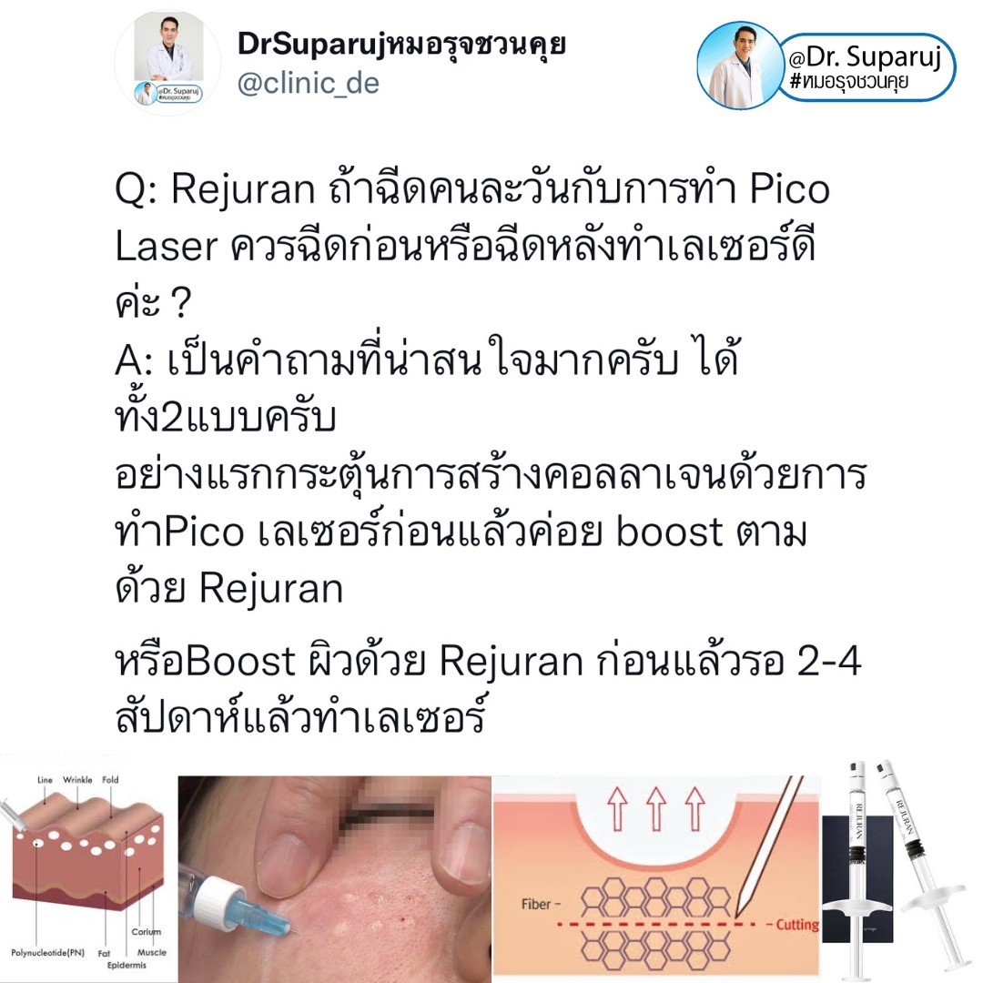 How to ดูแลตัวเองง่ายๆ หลังฉีด Rejuran How to ดูแลตัวเองง่ายๆ หลังฉีด Rejuran
