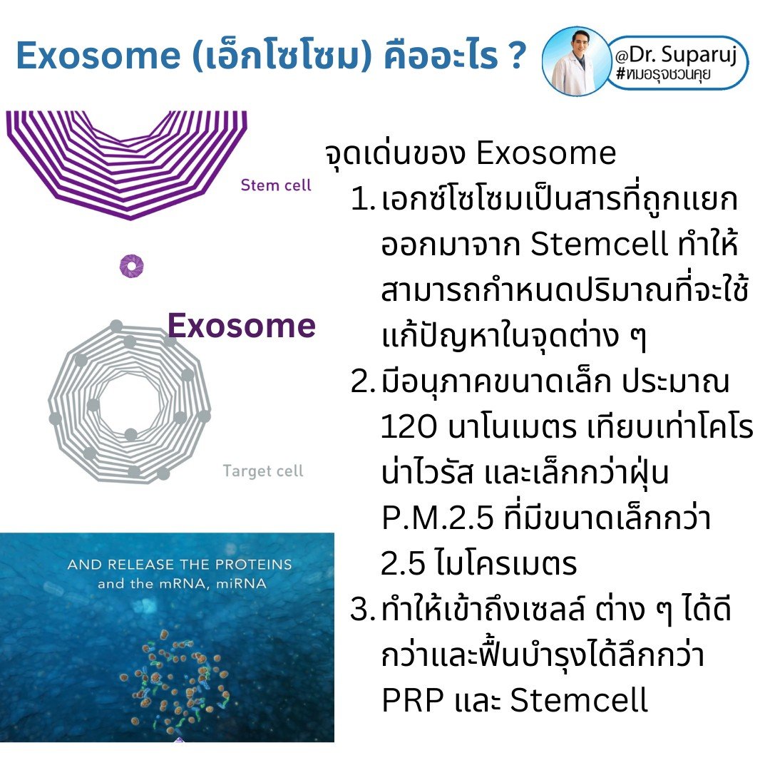 Exosome (เอ็กโซโซม) คือ เทคโนโลยีที่มีองค์ประกอบของโปรตีนขนาดเล็กมาก เป็นลักษณะวงกลมขนาดเพียง 30-100 nm ซึ่งมีขนาดเล็กกว่าเซลล์ทั่วไปถึง 1/1,000 เท่า โดยใน Exosome มีสารชีวโมเลกุล 1,000 ชนิด 