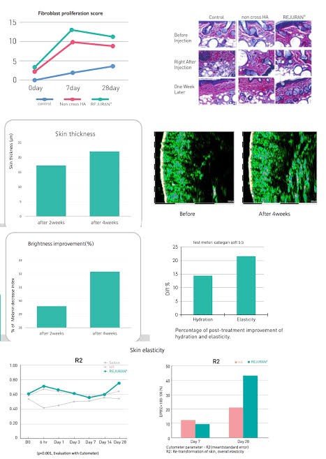 Rejuran Healer Polynucleotide Skin Booster ช่วยฟื้นฟูสร้างเซลล์ผิวใหม่ ดูแลหลุมสิว รูขุมขนกว้าง ริ้วรอย Rejuran Healer Polynucleotide Skin Booster ช่วยฟื้นฟูสร้างเซลล์ผิวใหม่ ดูแลหลุมสิว รูขุมขนกว้าง ริ้วรอย