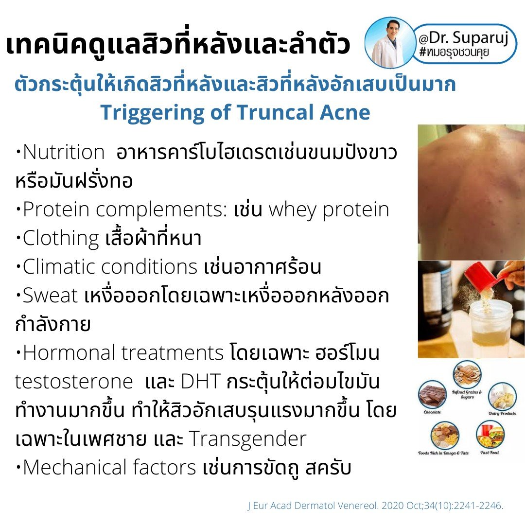 สิวที่หลัง และลำตัว Truncal & Body Acne เกิดจากอะไรและดูแลรักษาได้อย่างไร ? (Update + รีวิว)