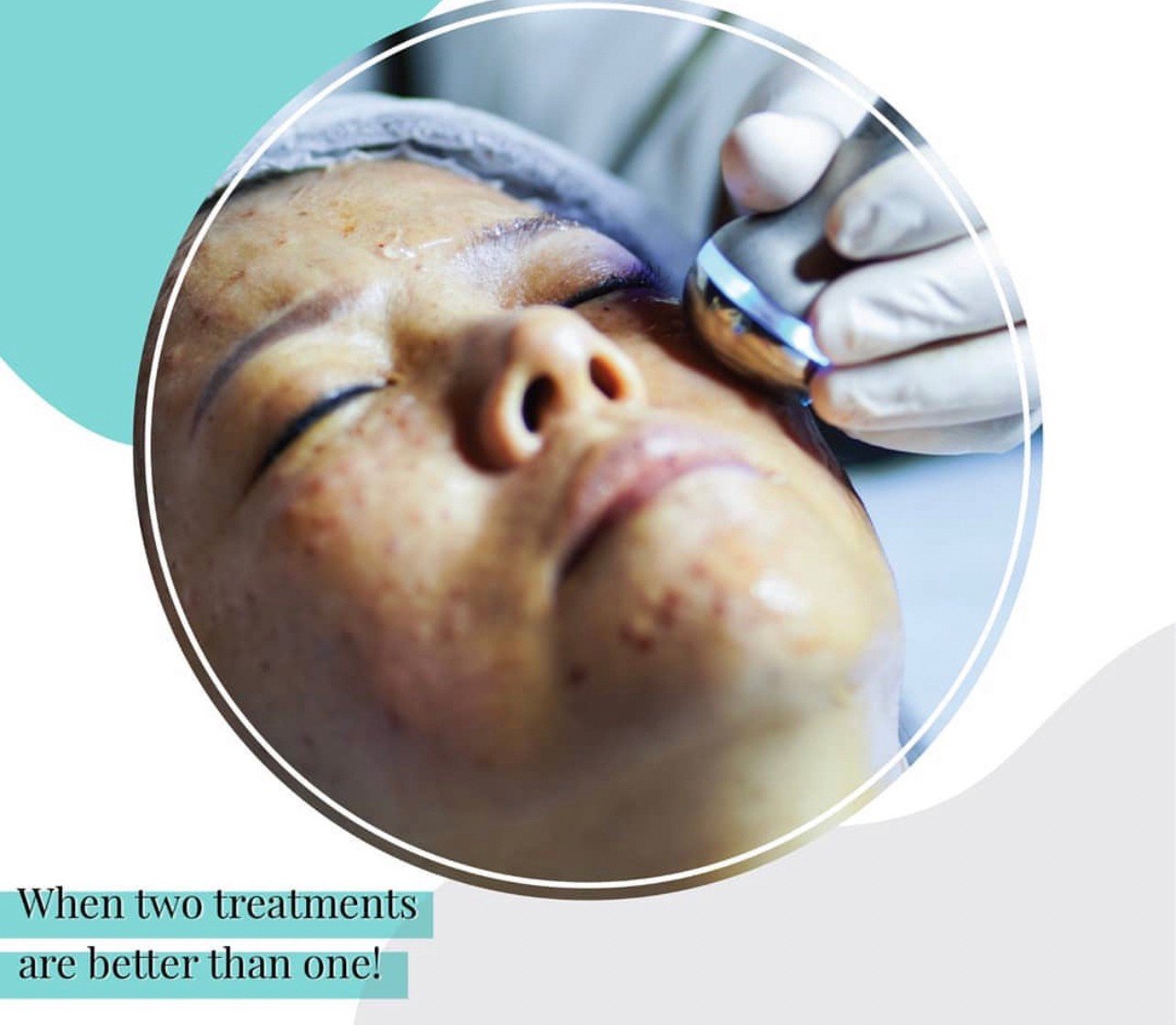 Rejuran Healer Polynucleotide Skin Booster ช่วยฟื้นฟูสร้างเซลล์ผิวใหม่ ดูแลหลุมสิว รูขุมขนกว้าง ริ้วรอย Rejuran Healer Polynucleotide Skin Booster ช่วยฟื้นฟูสร้างเซลล์ผิวใหม่ ดูแลหลุมสิว รูขุมขนกว้าง ริ้วรอย