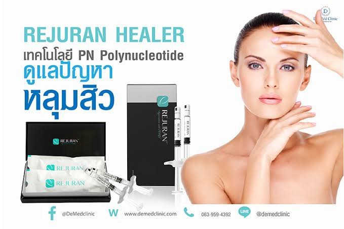 แนะนำเทคนิครักษาหลุมสิว: Rejuran Healer Polynucleotide รีจูรัน ดูแลหลุมสิว ฟื้นฟูสร้างเซลล์ผิวใหม่ แนะนำเทคนิครักษาหลุมสิว: Rejuran Healer Polynucleotide รีจูรัน ดูแลหลุมสิว ฟื้นฟูสร้างเซลล์ผิวใหม่