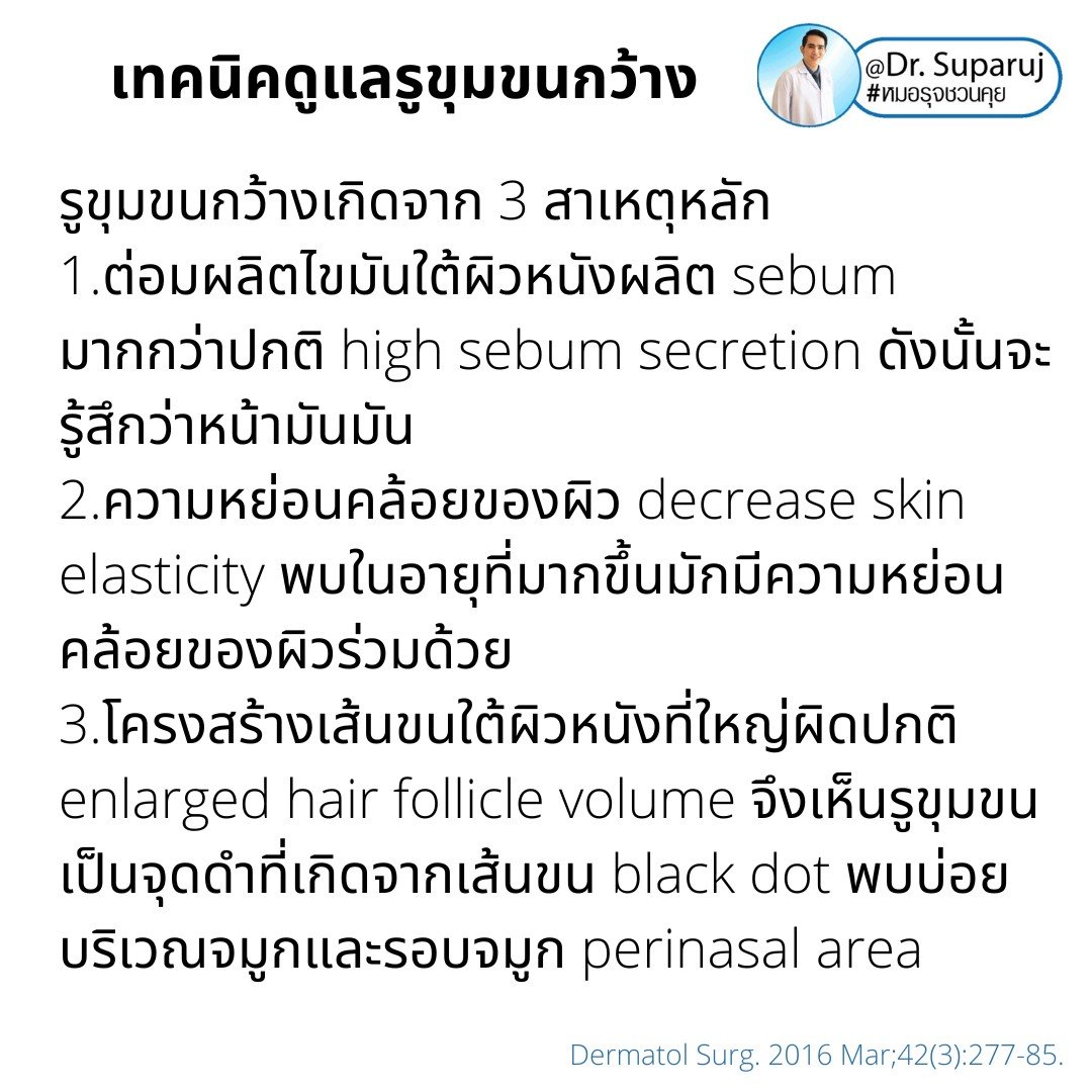 แนะนำเทคนิคดูแลรูขุมขนกว้าง: ตัวอย่างผลการดูแลรูขุมขนกว้าง Enlarged Facial Pore ด้วย MultiMode Picosecond Laser แนะนำเทคนิคดูแลรูขุมขนกว้าง: ตัวอย่างผลการดูแลรูขุมขนกว้าง Enlarged Facial Pore ด้วย MultiMode Picosecond Laser