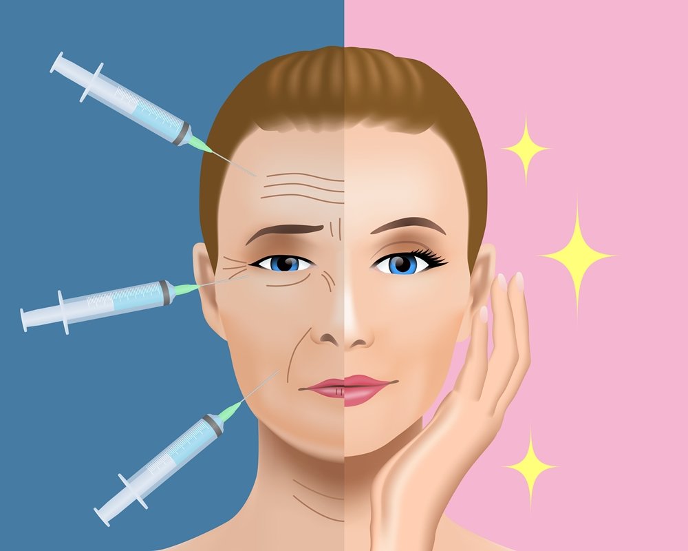 ฉีดโบท็อก Botox (Botulinum Toxin) คืออะไร? ช่วยดูแลปัญหาอะไร เหมาะกับใครบ้าง? ฉีดโบท็อก Botox (Botulinum Toxin) คืออะไร? ช่วยดูแลปัญหาอะไร เหมาะกับใครบ้าง?