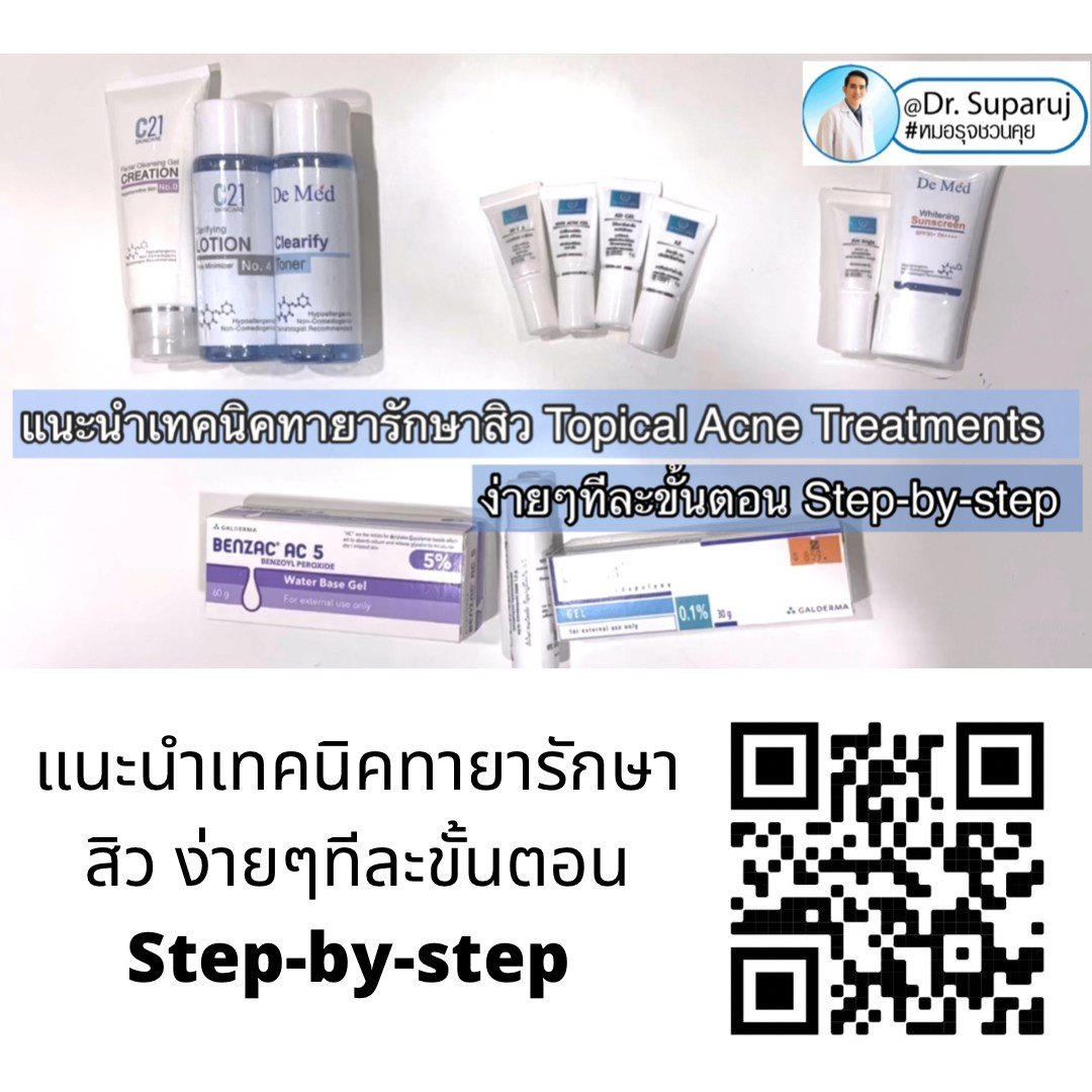 แนะนำเทคนิคทายารักษาสิว ง่ายๆทีละขั้นตอน Step-by-step ตาม Link นี้เลยครับ