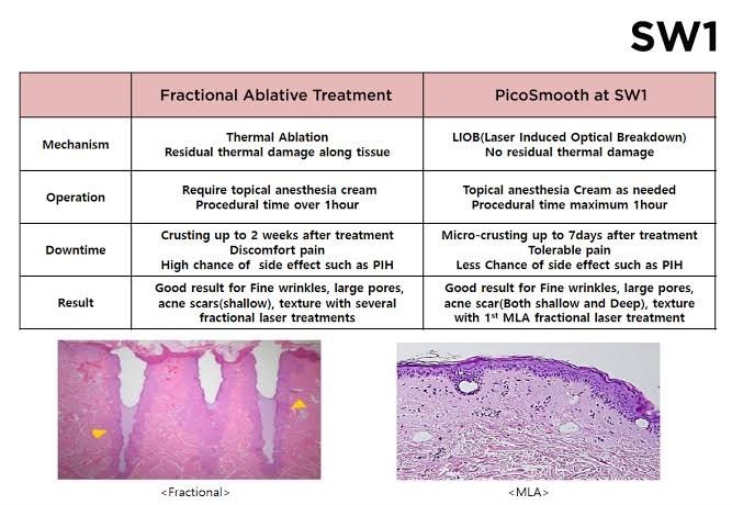เทคนิครักษาหลุมสิวด้วย Picosecond Laser VS InfiniRF Microneedle แตกต่างกันอย่างไร อันไหนมีประสิทธิภาพดีกว่า ? เทคนิครักษาหลุมสิวด้วย Picosecond Laser VS InfiniRF Microneedle แตกต่างกันอย่างไร อันไหนมีประสิทธิภาพดีกว่า ?