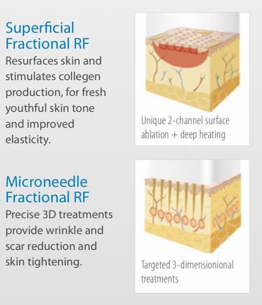 เทคนิครักษาหลุมสิวด้วย Picosecond Laser VS InfiniRF Microneedle แตกต่างกันอย่างไร อันไหนมีประสิทธิภาพดีกว่า ? เทคนิครักษาหลุมสิวด้วย Picosecond Laser VS InfiniRF Microneedle แตกต่างกันอย่างไร อันไหนมีประสิทธิภาพดีกว่า ?