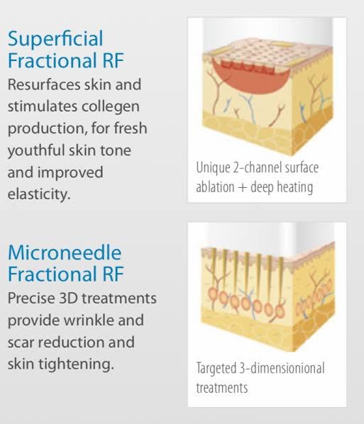 เทคนิครักษาหลุมสิวด้วย Picosecond Laser VS InfiniRF Microneedle แตกต่างกันอย่างไร อันไหนมีประสิทธิภาพดีกว่า ?