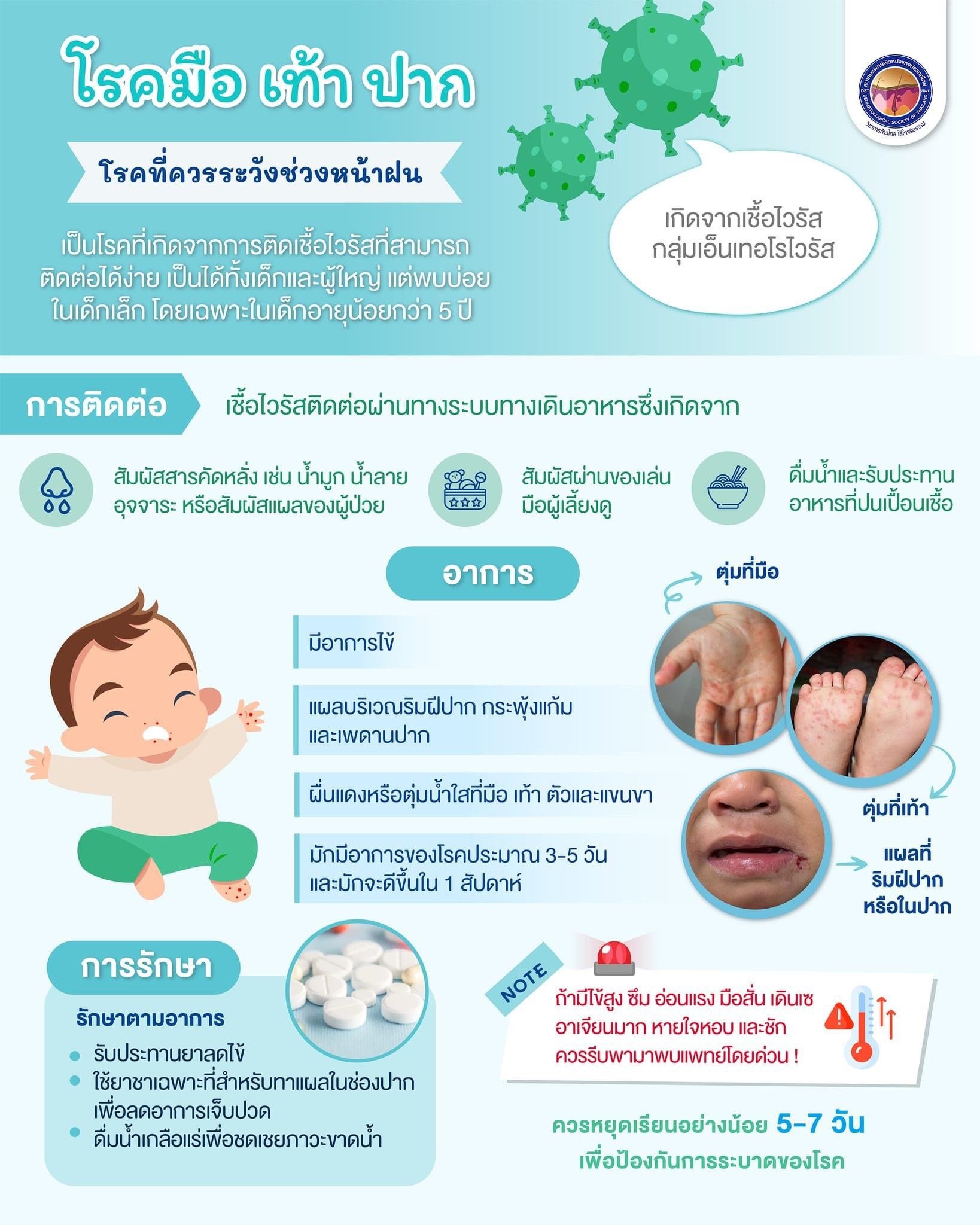 มือ เท้า ปาก โรคที่ควรระวังช่วงหน้าฝน มือ เท้า ปาก โรคที่ควรระวังช่วงหน้าฝน