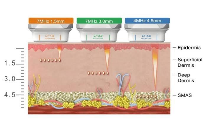 หนังตาหย่อนคล้อยเกิดจากอะไร & เทคนิคดูแลหนังตาหย่อนคล้อยโดยไม่ต้องผ่าตัด หนังตาหย่อนคล้อยเกิดจากอะไร & เทคนิคดูแลหนังตาหย่อนคล้อยโดยไม่ต้องผ่าตัด