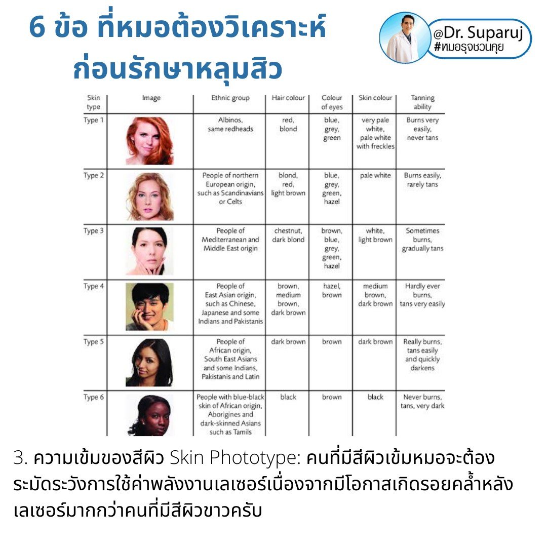 แนะนำเทคนิคดูแลหลุมสิว: เทคนิคดูแลหลุมสิวที่หมอรุจใช้บ่อย Multimodality Acne Scar Treatment Approach แนะนำเทคนิคดูแลหลุมสิว: เทคนิคดูแลหลุมสิวที่หมอรุจใช้บ่อย Multimodality Acne Scar Treatment Approach