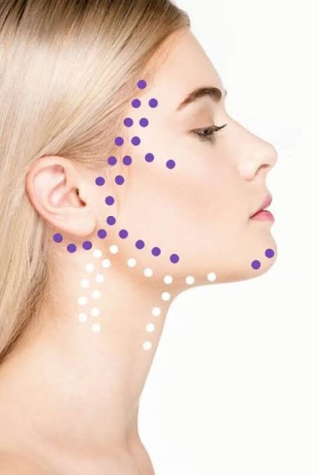 ฉีดโบท็อกเทคนิค Botox DermoLifting กระชับกรอบหน้า มีเทคนิคอย่างไร? & ข้อควรระวังที่สำคัญก่อนฉีด ฉีดโบท็อกเทคนิค Botox DermoLifting กระชับกรอบหน้า มีเทคนิคอย่างไร? & ข้อควรระวังที่สำคัญก่อนฉีด