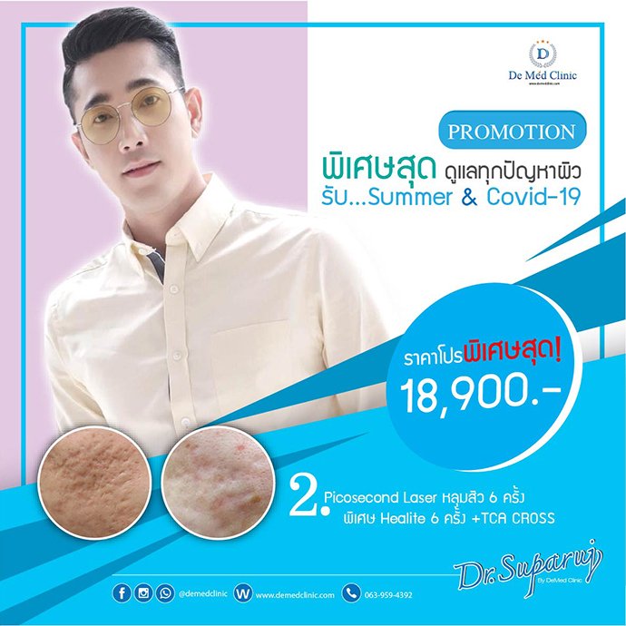 Promotion พิเศษสุดๆ ดูแลทุกปัญหาผิว รับ Summer& Covid ดูแลผิวหน้า หมอขอดูแลด้วยโปรโมชั่นพิเศษสุดสุด